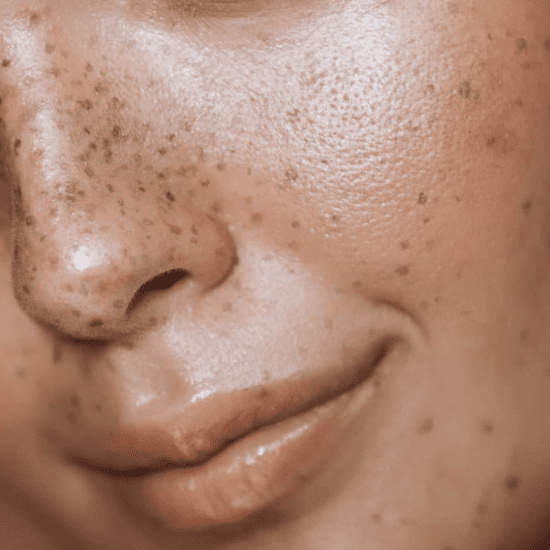 skin problems