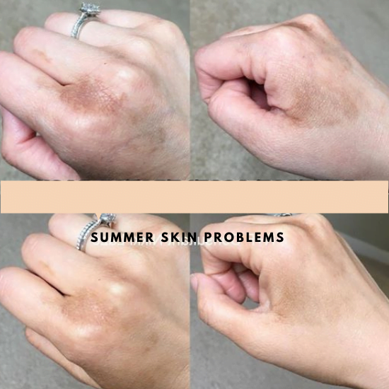 skin problems